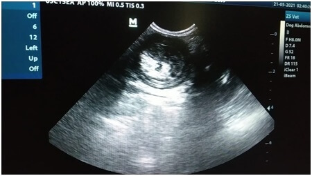Fig 2 – Transverse section reveals target sign appearance in sonography.