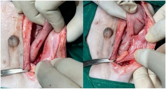 Fig 4.  Colopexy was performed to create permanent adhesions between the serosal surfaces of the colon and the abdominal wall.