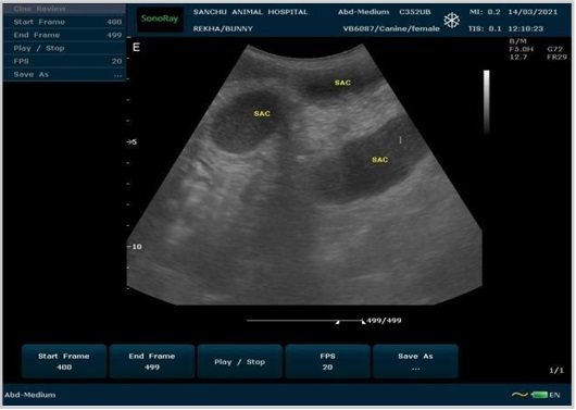 Fig B. Ultrasonography of the uterus. Multiple anechoic sacculation noticed